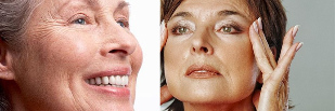 Wrinkles jeung parobahan patali umur-